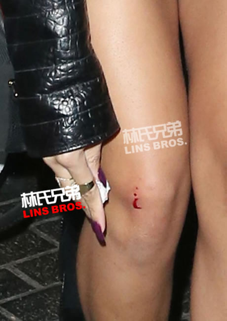 Rihanna在伦敦夜店遭男子袭击流血..因为和Chris Brown的关系 (照片)