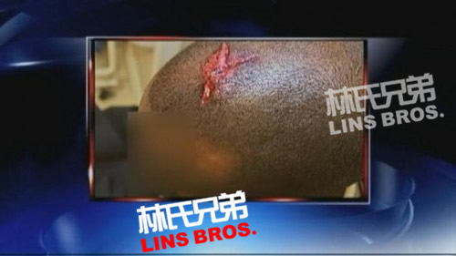 Gucci Mane被通缉..亚特兰大警方控告他袭击阿富汗美军士兵...头部缝了10针 (照片)