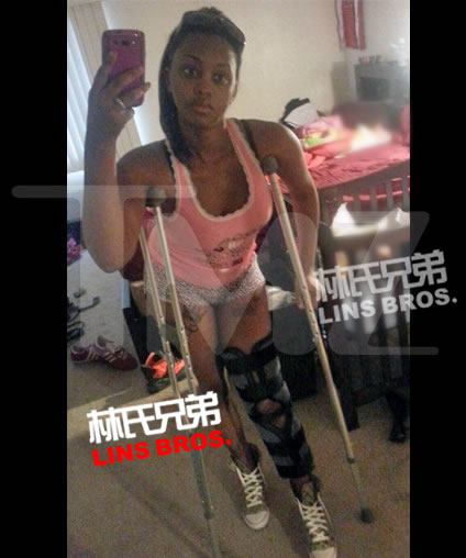 Chris Brown被一名女子控告在夜店内推她导致受伤..女子发布照片拄着拐杖 (照片)