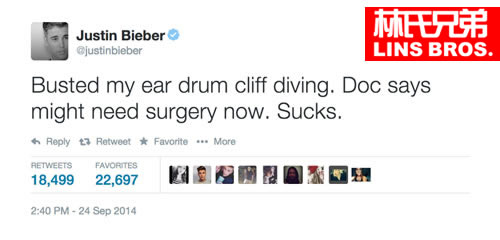 发生了什么? Justin Bieber说可能要做手术..该死的悬崖跳水 (截图/视频)