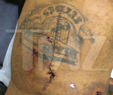 恐怖的6枪子弹打过Tuapc前老板Suge Knight身体手术后照片..非常刺激神经 (6张照片)