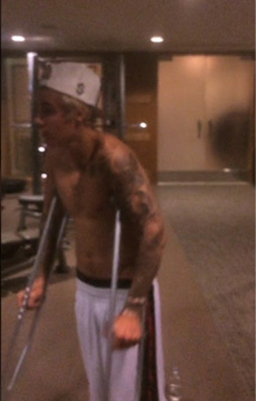 进化成肌肉男的Justin Bieber腿受伤得靠拐杖帮忙..但他想证明自己依旧是个男人  (照片)
