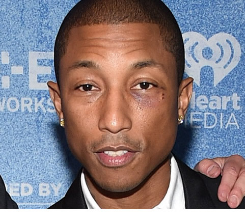 发生了什么?!! Pharrell被打成熊猫眼..据说是被Jay Z揍, 不过事实上是因为这个 (照片)