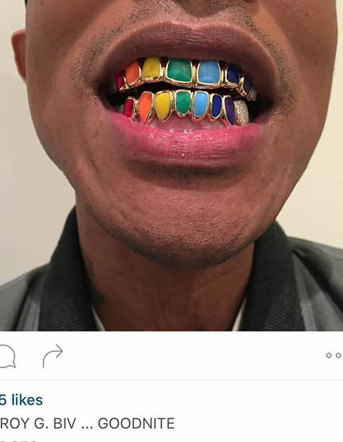 贵! Pharrell心情大好套上新的五颜六色牙套..为假日增添色彩 (照片)