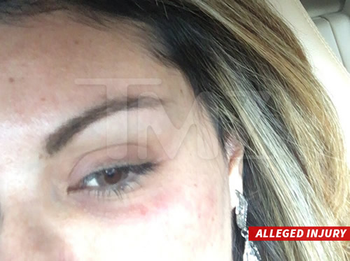 新年就遇到麻烦事..Chris Brown被控告殴打这个女人..她放出脸部受伤照片..Breezy愤怒回击 (+警方在现场照片)