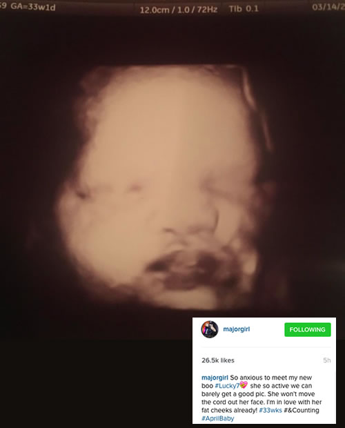 T.I.和老婆Tiny女儿要出生了..这是Tiny怀孕肚子里宝宝B超照片..婴儿脸特写..像T.I. (照片)
