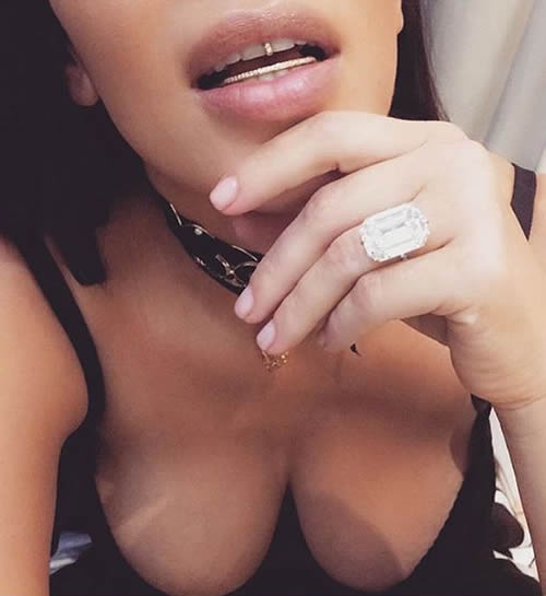 Kanye West影响了老婆卡戴珊..她展示她的金牙套 + Sexy照片