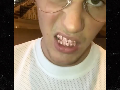 Ballin! Justin Bieber搞了个玫瑰金的牙套..酷毙 (视频照片)