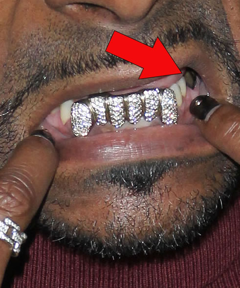 Snoop Dogg自信展示牙齿新装备..不过媒体不是省油的灯，指出了状况不佳的那颗牙齿..有点尴尬..