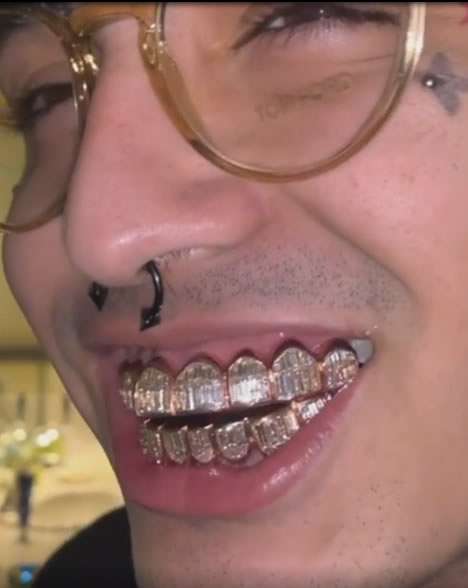 Lil Pump大秀昂贵钻石牙套，花了他约170万元