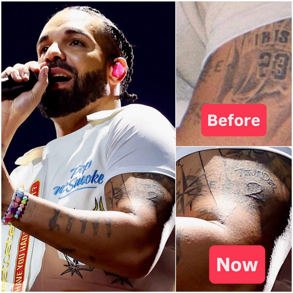 Drake已经把勒布朗纹身擦掉